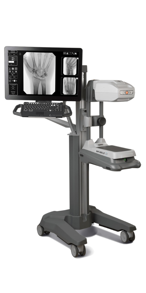 Orthoscan Mobile DI Mini C-Arm